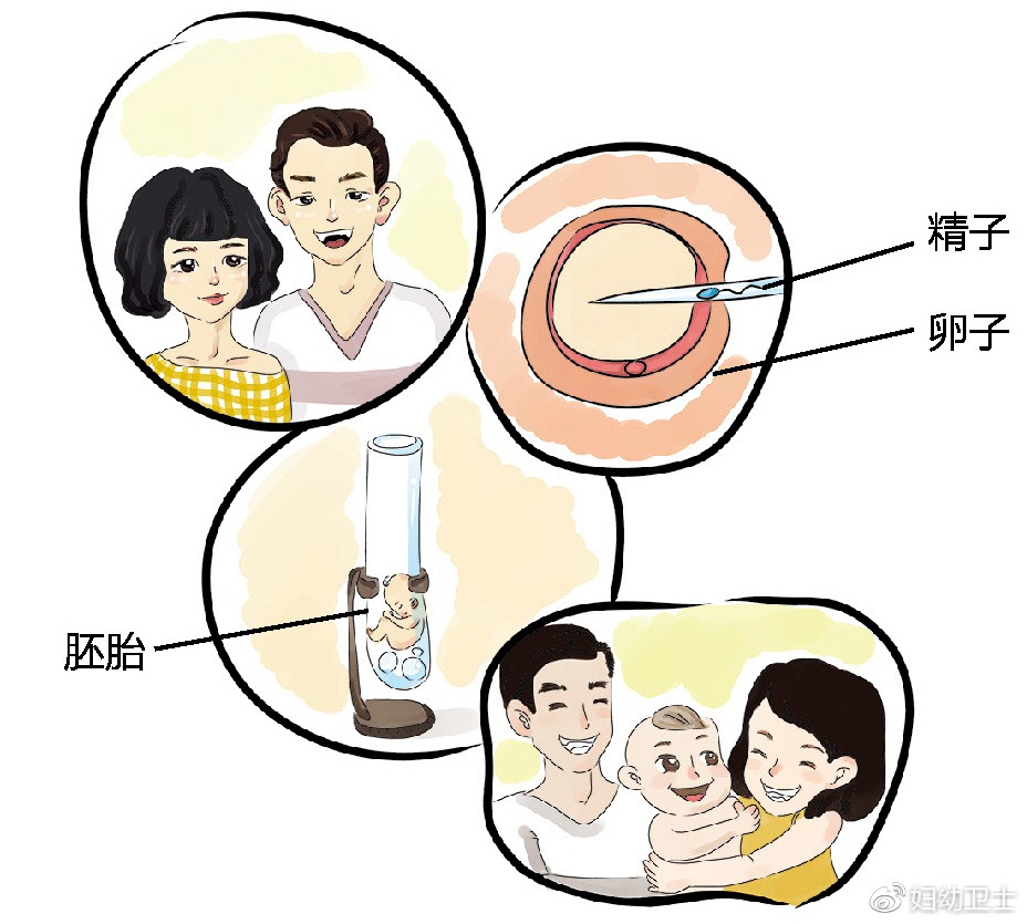 不孕症