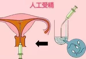 不孕可以治好吗