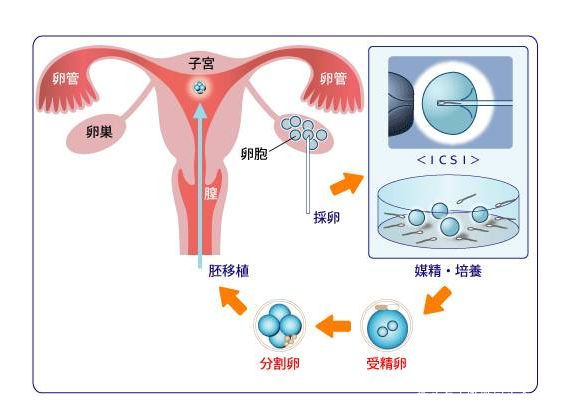 不孕不育