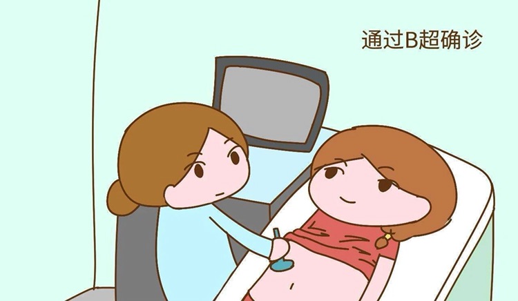 不孕中药调理