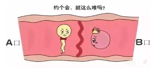 不孕症