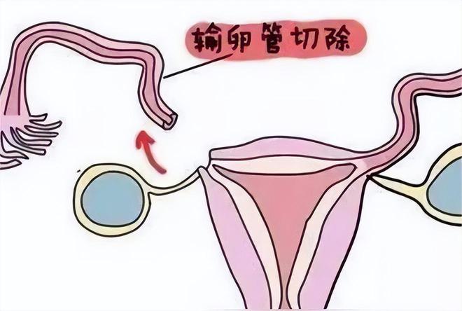 不孕五项
