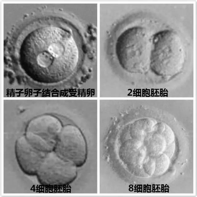 高龄试管婴儿
