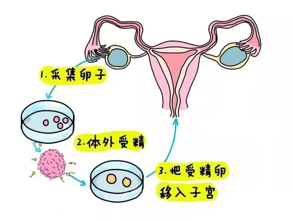 意外怀孕